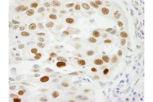 Immunohistochemistry (IHC) image for anti-Importin Subunit alpha-1 (KPNA2) (C-Term) antibody (ABIN7448767) (Importin Subunit alpha-1 (KPNA2) (C-Term) Antikörper)