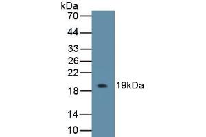 Detection of Recombinant IL18BP, Mouse using Polyclonal Antibody to Interleukin 18 Binding Protein (IL18BP) (IL18BP Antikörper  (AA 29-193))