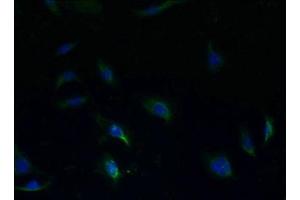 Immunofluorescent analysis of HepG2 cells using ABIN7170565 at dilution of 1:100 and Alexa Fluor 488-congugated AffiniPure Goat Anti-Rabbit IgG(H+L) (S1PR1 Antikörper  (AA 311-382))