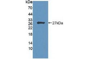 Detection of Recombinant HIPK2, Human using Polyclonal Antibody to Homeodomain Interacting Protein Kinase 2 (HIPK2) (HIPK2 Antikörper  (AA 977-1198))