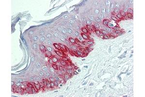Anti-HDX antibody IHC of human skin. (HDX Antikörper  (N-Term))