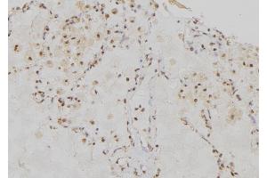 ABIN6276555 at 1/100 staining Human lung tissue by IHC-P. (RRM1 Antikörper  (Internal Region))