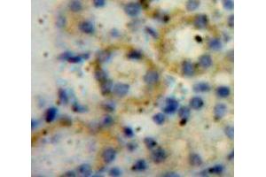 Immunohistochemistry (IHC) image for anti-ADAM Metallopeptidase with Thrombospondin Type 1 Motif, 1 (ADAMTS1) (AA 560-911) antibody (ABIN1077724)