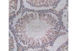 Immunohistochemistry (IHC) image for anti-serpin Peptidase Inhibitor, Clade A (Alpha-1 Antiproteinase, Antitrypsin), Member 6 (SERPINA6) (AA 173-344) antibody (ABIN7428320)