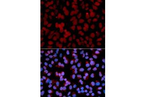 Immunofluorescence analysis of U2OS cells using TNF antibody (ABIN6128830, ABIN6149292, ABIN6149293 and ABIN6217713). (TNFAIP3 Antikörper  (AA 1-190))