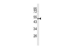 Western Blotting (WB) image for anti-Cytochrome P450, Family 24, Subfamily A, Polypeptide 1 (CYP24A1) (AA 466-494), (C-Term) antibody (ABIN652590)
