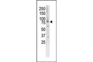 Western Blotting (WB) image for anti-Muscle, Skeletal, Receptor Tyrosine Kinase (MUSK) (AA 829-859), (C-Term) antibody (ABIN392020)