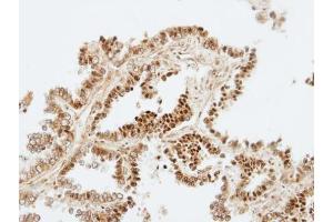 IHC-P Image Immunohistochemical analysis of paraffin-embedded human normal lung, using ZKSCAN3, antibody at 1:100 dilution. (ZKSCAN3 Antikörper)
