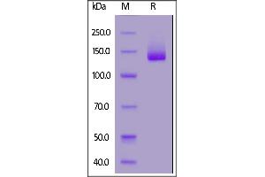 Human NCAM-1, Fc Tag on  under reducing (R) condition. (CD56 Protein (AA 20-718) (Fc Tag))