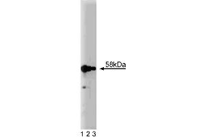 Western Blotting (WB) image for anti-Karyopherin alpha 2 (RAG Cohort 1, Importin alpha 1) (KPNA2) (AA 254-497) antibody (ABIN967998)