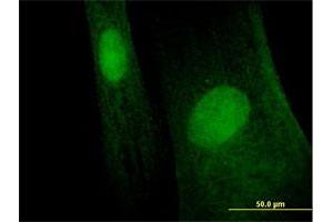 Immunofluorescence of purified MaxPab antibody to MAGEB6 on Hs 181. (MAGEB6 Antikörper  (AA 1-407))
