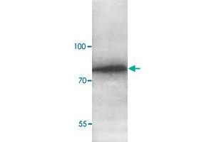 Western blot analysis of human fetal liver lysate with ABCG8 polyclonal antibody  at 1 : 1000 dilution. (ABCG8 Antikörper  (C-Term))