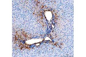 IHC analysis of CD31/Pecam1 using anti-CD31/Pecam1 antibody (ABIN7601662). (CD31 Antikörper  (AA 41-258))