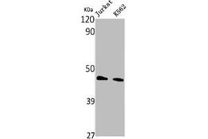 Western Blot analysis of Jurkat K562 cells using PHKG1 Polyclonal Antibody (PHKG1 Antikörper  (Internal Region))