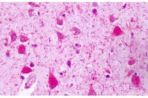 Anti-GPRC5A / RAI3 antibody IHC staining of human brain, neurons. (GPRC5A Antikörper  (C-Term))
