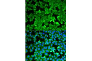 Immunofluorescence analysis of A549 cells using ASNS antibody. (Asparagine Synthetase Antikörper  (AA 262-561))