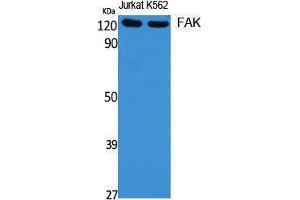Western Blotting (WB) image for anti-PTK2 Protein tyrosine Kinase 2 (PTK2) (Thr450) antibody (ABIN6284739)