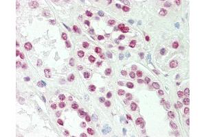 Anti-TLX1 / HOX11 antibody IHC staining of human kidney. (TLX1 Antikörper  (AA 163-191))
