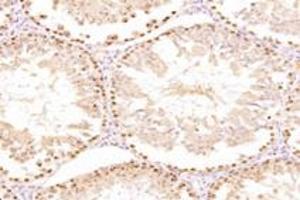 Immunohistochemistry analysis of paraffin-embedded mouse testis using,ZSCAN20 (ABIN7076252) at dilution of 1: 3000 (ZSCAN20 Antikörper)