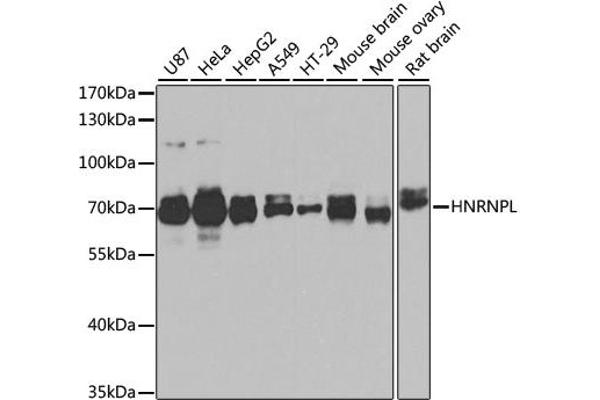 HNRNPL Antikörper  (AA 282-589)