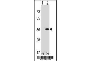 Western Blotting (WB) image for anti-Guanine Nucleotide Binding Protein (G Protein), Q Polypeptide (GNAQ) (AA 52-78), (N-Term) antibody (ABIN5535218)