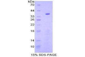 SDS-PAGE analysis of Mouse GSK3a Protein.