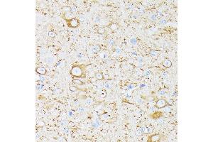 Immunohistochemistry of paraffin-embedded mouse brain using βIII-Tubulin/β3-Tubulin  at dilution of 100 (40x lens). (TUBB3 Antikörper)