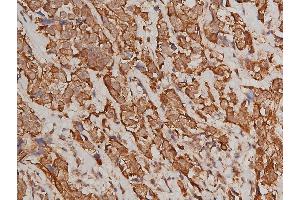 Immunohistochemistry (IHC) image for anti-Keratin 8 (KRT8) (pSer432) antibody (ABIN6255334)