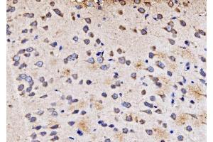IHC analysis of PMPCA/INPP5 using anti-PMPCA/INPP5 antibody (ABIN7602722). (PMPCA Antikörper  (AA 99-525))