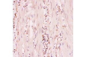 Immunohistochemistry (IHC) image for anti-ATP-Binding Cassette, Sub-Family C (CFTR/MRP), Member 4 (ABCC4) (AA 1-370) antibody (ABIN3043774)