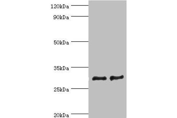 ATP5F1 Antikörper  (AA 1-245)