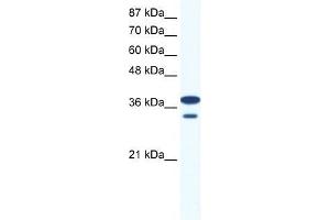 Human Jurkat; WB Suggested Anti-LHX3 Antibody Titration: 0. (LHX3 Antikörper  (Middle Region))