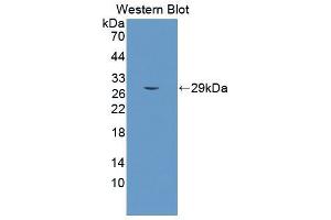 Western blot analysis of the recombinant protein. (PSMA Antikörper  (AA 536-752))