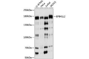 Western blot analysis of extracts of various cell lines, using EPB41L2 antibody (ABIN6131606, ABIN6140199, ABIN6140200 and ABIN6224888) at 1:1000 dilution. (EPB41L2 Antikörper  (AA 1-210))