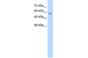 WB Suggested Anti-C20orf18 Antibody Titration:  1. (RBCK1 Antikörper  (Middle Region))