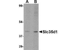 Western Blotting (WB) image for anti-Solute Carrier Family 35 (UDP-Glucuronic Acid/UDP-N-Acetylgalactosamine Dual Transporter), Member D1 (SLC35D1) (N-Term) antibody (ABIN1031577) (SLC35D1 Antikörper  (N-Term))