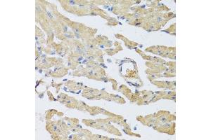 Immunohistochemistry of paraffin-embedded mouse heart using UCN2 antibody (ABIN5973879) at dilution of 1/100 (40x lens). (Urocortin 2 Antikörper)