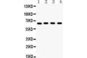 Anti- NF-kB p65 Picoband antibody, Western blottingAll lanes: Anti NF-kB p65  at 0. (NF-kB p65 Antikörper  (AA 291-479))