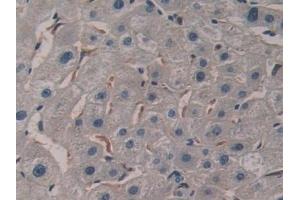 Detection of PTI in Human Liver Tissue using Polyclonal Antibody to Placental Thrombin Inhibitor (PTI)