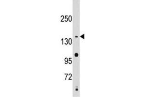 Western blot analysis of SMC2 antibody and Jurkat lysate.