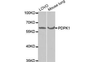 Western blot analysis of extracts of various cell lines, using PDPK1 antibody (ABIN5970826) at 1/1000 dilution. (PDPK1 Antikörper)