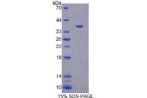 SDS-PAGE analysis of Human XRN1 Protein. (XRN1 Protein)