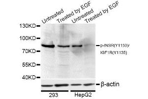 Western blot analysis of extracts of 293 and HepG2 cells, using Phospho-INSR-Y1150/IGF1R-Y1135 antibody (ABIN5969901) at 1/1000 dilution. (Insulin Receptor Antikörper  (pTyr1135, pTyr1150))