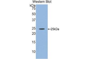 Western Blotting (WB) image for anti-Fibulin 2 (FBLN2) (AA 1013-1221) antibody (ABIN1858811) (FBLN2 Antikörper  (AA 1013-1221))