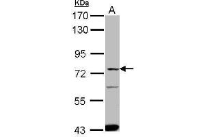 Western Blotting (WB) image for anti-Solute Carrier Family 27 (Fatty Acid Transporter), Member 4 (SLC27A4) (Center) antibody (ABIN2854876)