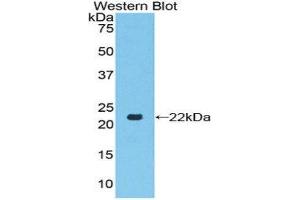 Western Blotting (WB) image for anti-Toll-Like Receptor 7 (TLR7) (AA 887-1036) antibody (ABIN1860776) (TLR7 Antikörper  (AA 887-1036))