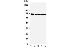 Western blot testing of OSBP antibody and Lane 1:  rat kidney;  2: (r) spleen;  3: (r) lung;  4: human HeLa;  5: (h) A549 cell lysate (OSBP Antikörper  (Middle Region))