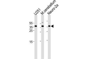 Western Blotting (WB) image for anti-Empty Spiracles Homeobox 1 (EMX1) antibody (ABIN3003987) (EMX1 Antikörper)