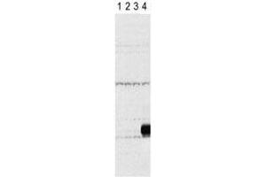 Western blot testing of Aurora-C antibody and lysate of 293 cells expressing Flag tag (lane 1), Flag-tagged Aurora-A (2), -B (3), -C (4). (Aurora Kinase C Antikörper  (AA 3-38))