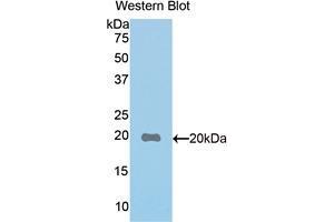Western blot analysis of the recombinant protein. (PON1 Antikörper  (AA 187-354))